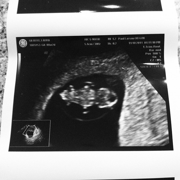Baby Gilbert. We just heard the news!