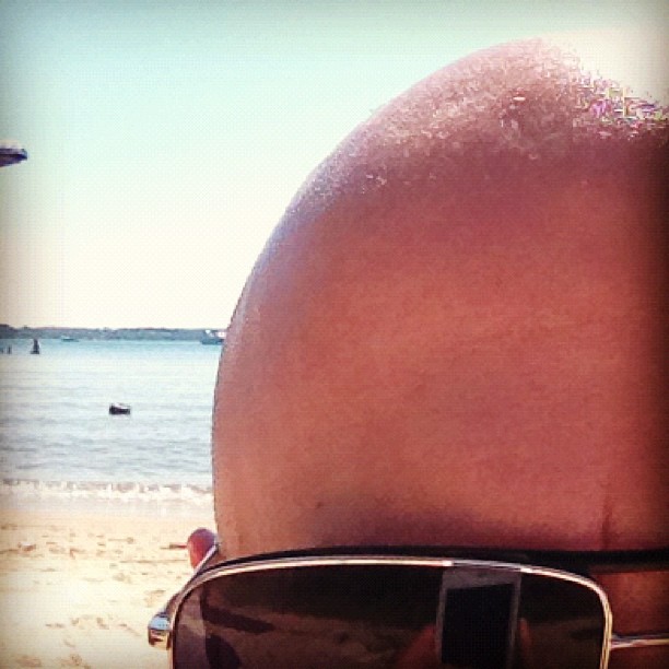Sunburn waiting to happen