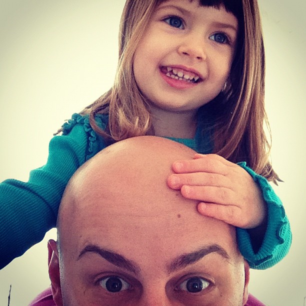 I have something growing out of my head.