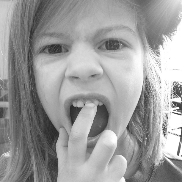Emmy has a loose tooth!